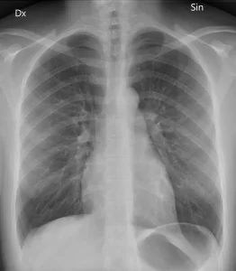 Medical Greyscale Imaging
